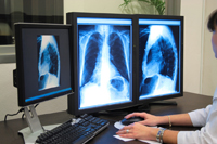 Digital X-ray | Open High Field MRI | Fluoroscopy | Staten Island